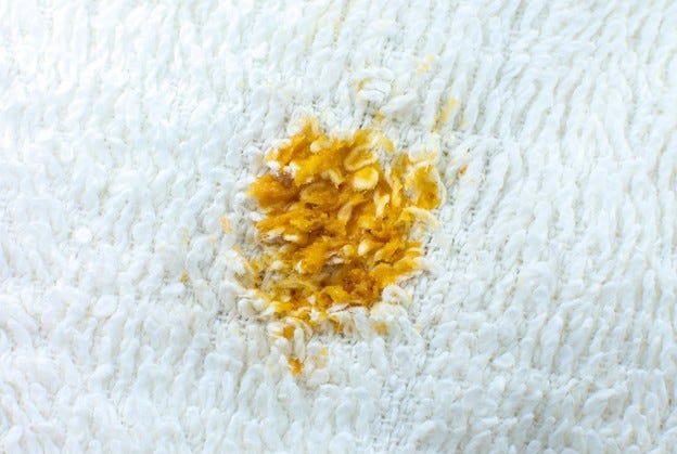 How to Remove Mustard Stains from Carpet