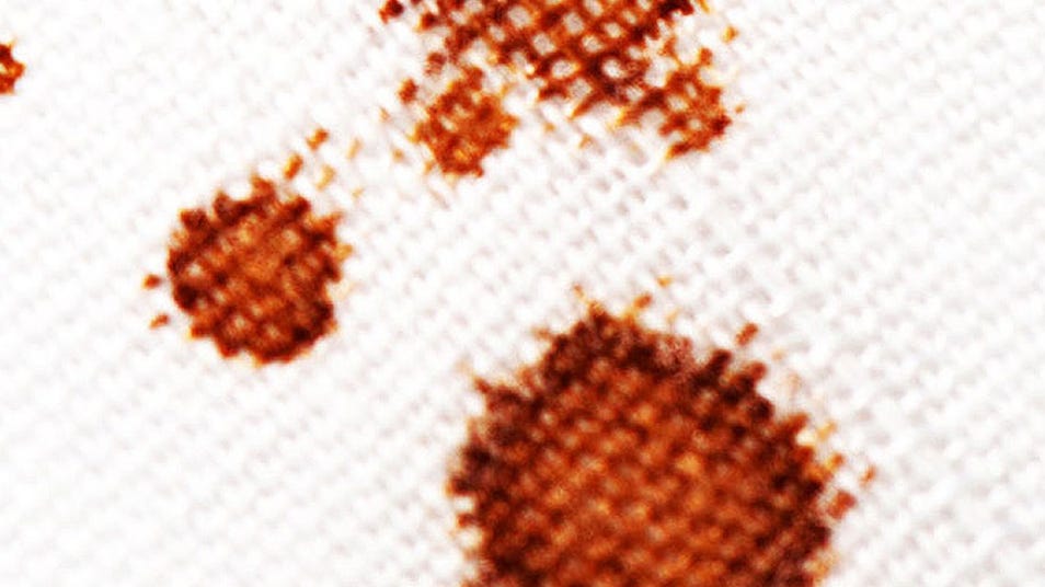 Brown stains on white fabric