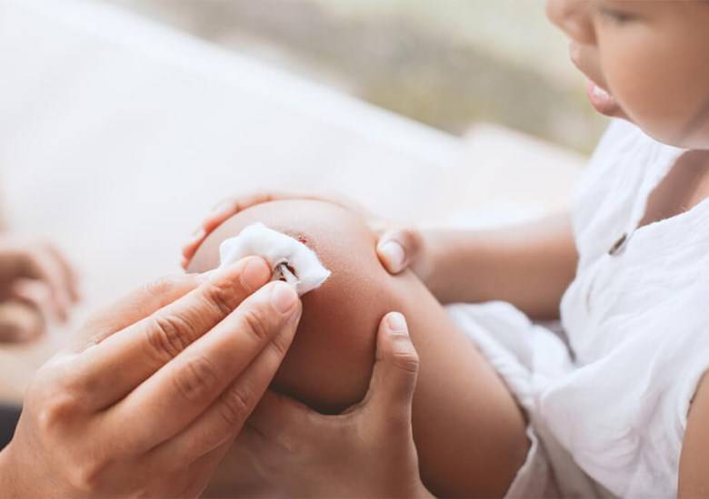 Så tar du bort blodfläckar