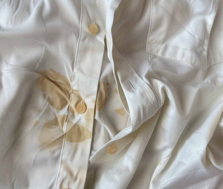 Beyazlardaki Lekeler Nasıl Çıkar?