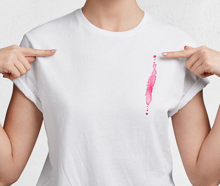 Pancar Lekesi Nasıl Çıkar?