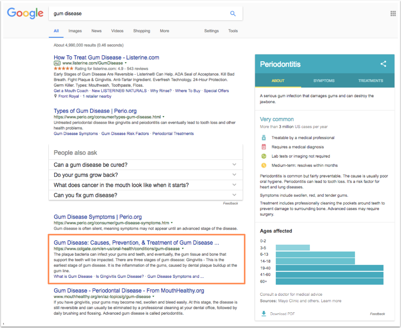 google-search-results-gum-disease-1.png