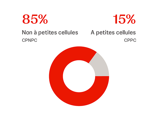 Il existe deux principaux types de cancer du poumon<sup className="footnote existing" key=0>1</sup>