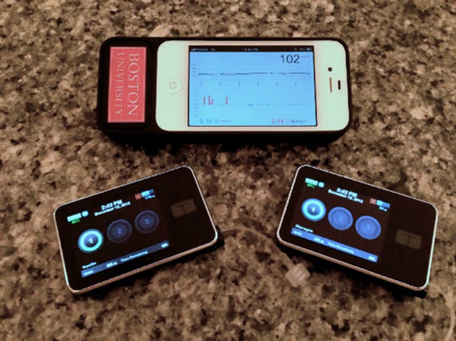 Engineers from Boston University created a closed-loop bionic pancreas system that uses continuous glucose monitoring and sub