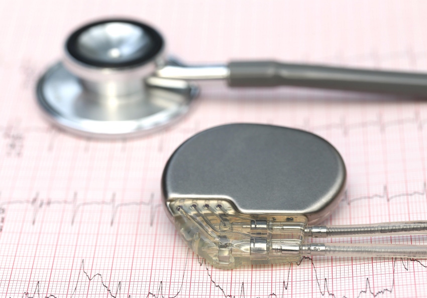 Close up of electrocardiograph with stethoscope and pacemaker