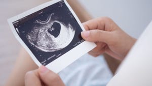 A piece of paper showing a picture of an ultrasound of a baby
