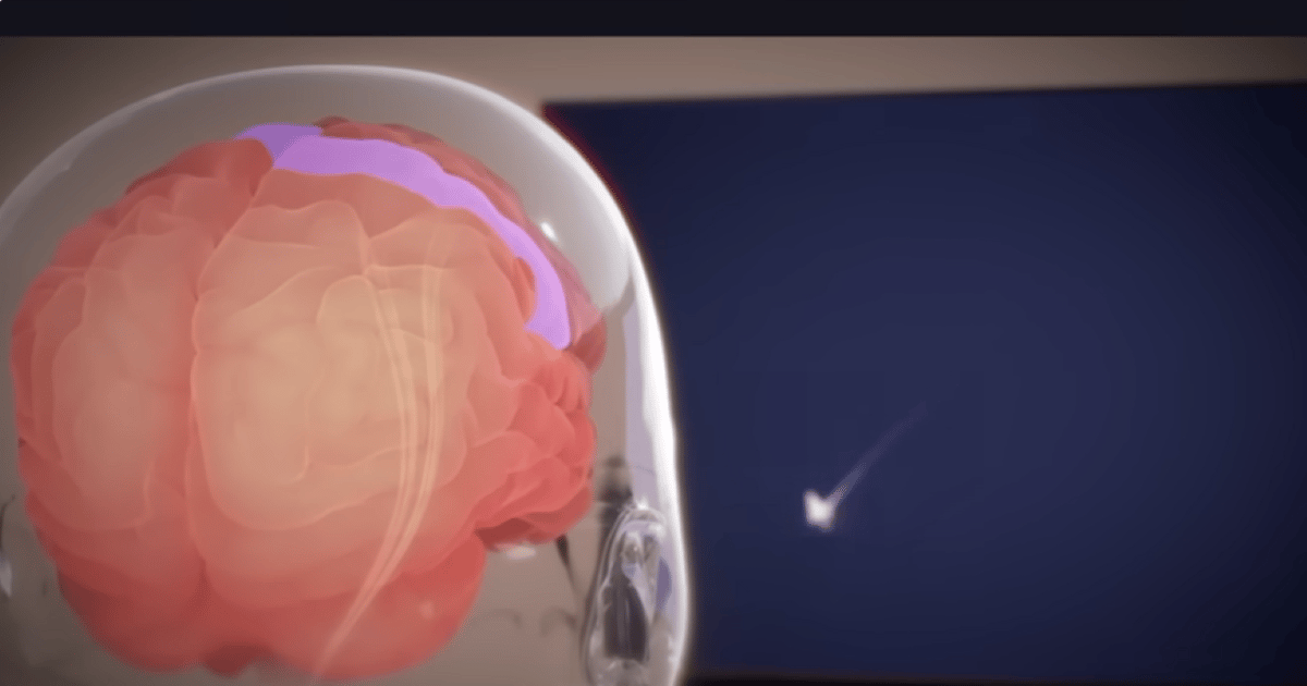 ALS-patiënt gebruikt Musk's Neuralink hersenchip om video te creëren