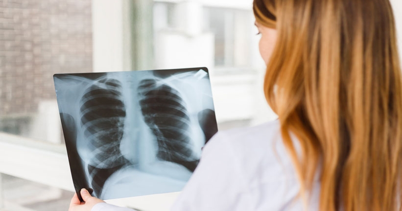 US Study Suggests AI More Accurate At Detecting Lung Cancer | AI Business