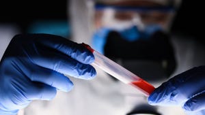 A scientist in lab robs holds up a blood test vial wearing blue gloves