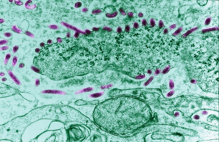 Close up of Ebola virus 