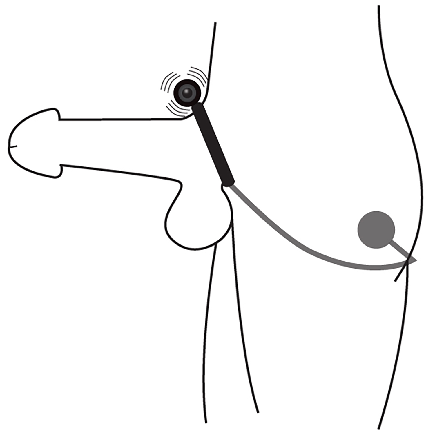 Master Series Odyssey Vibrerande Penisring med Anal Stimulator 1
