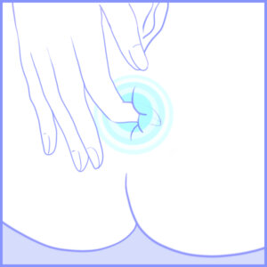 Illustrasjon av anal shallowing; nærbilde av finger som er litt inni anus