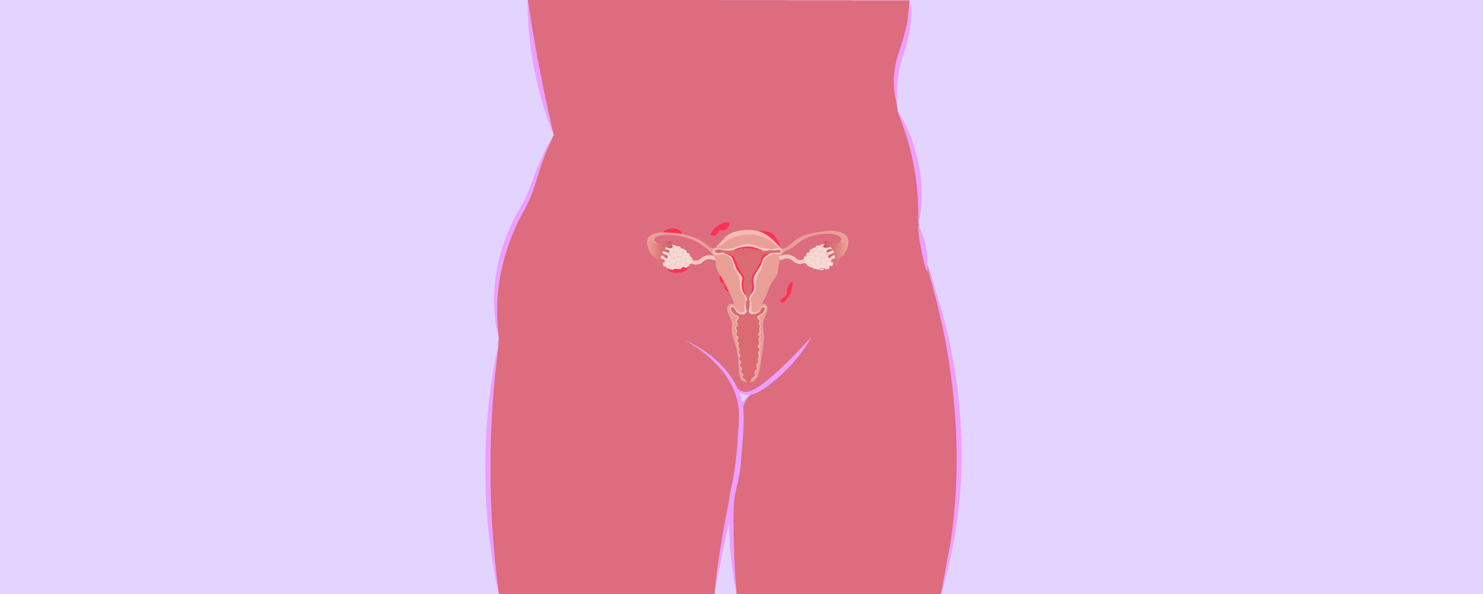 Illustration af en kvindes underliv