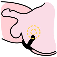 Illustration of the prostate