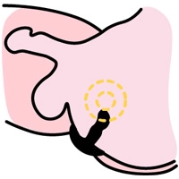 Illustration af prostata