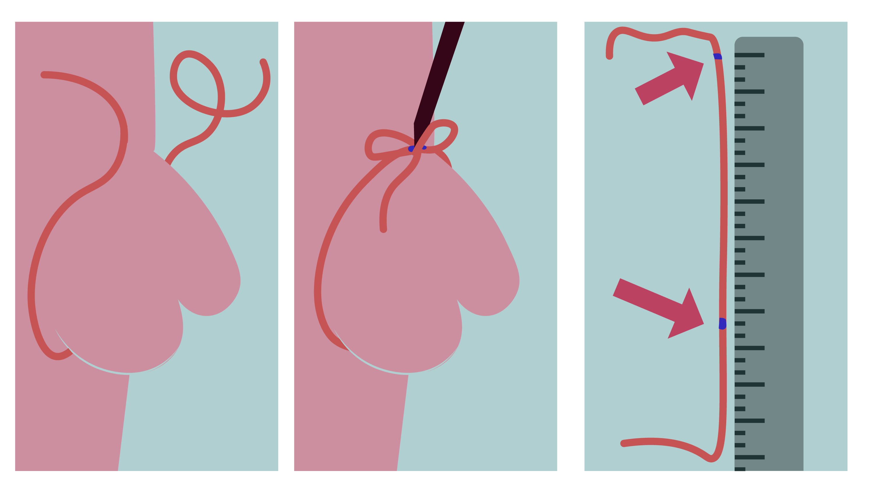 Une ficelle est nouée autour d'un pénis, puis placée à côté d'une règle.