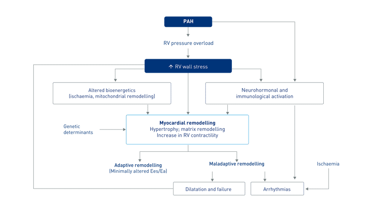 PAH-Ventricular-disfunction PAH-Ventricular-disfunction
