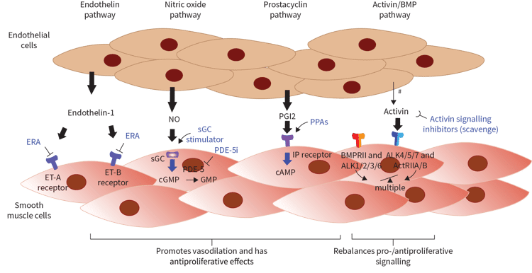Hormonal pathways Three pathogenic signalling pathways are targeted in the treatment of PAH