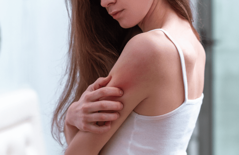Dermatology-home-dermatologie-psoriasis Dermatology-home-dermatologie-psoriasis