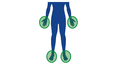 Περιοχές που προσβάλλονται