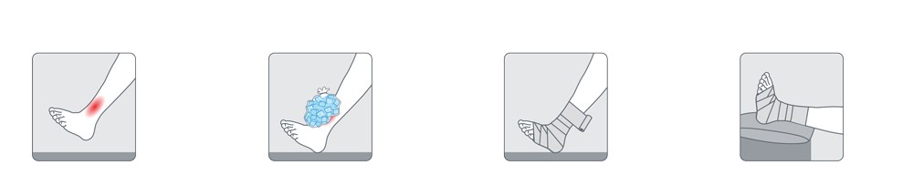 Как се лекуват изкълчванията и навяхванията?