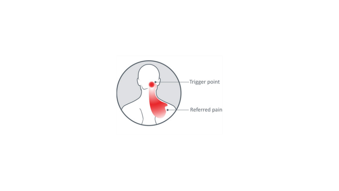 Zdroj běžné bolesti hlavy