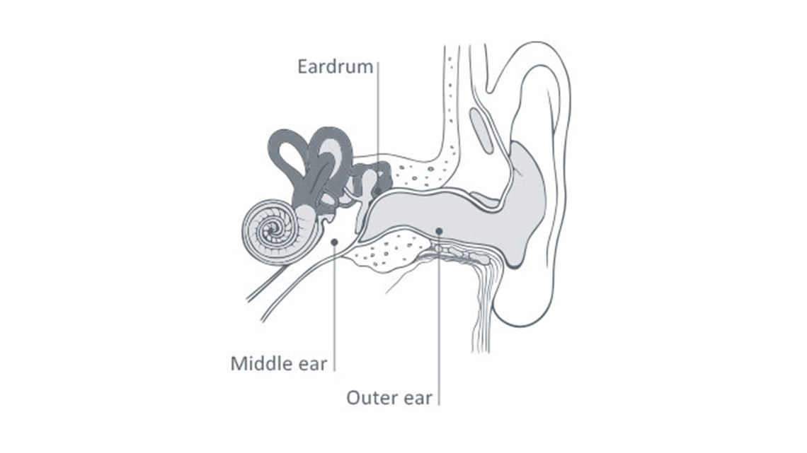 kids earaches