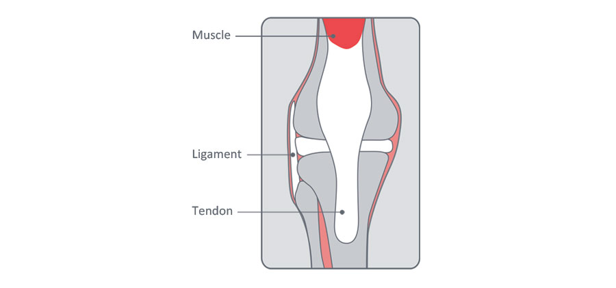 strains and sprains