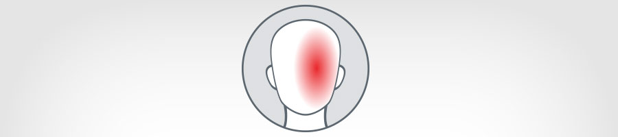 migraine