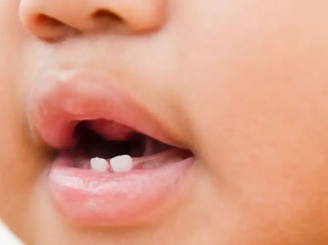 soothe teething baby