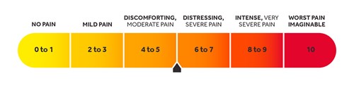 Diagram with a measurement showing 0 to 1 to indicate no pain and 10 to indicate the worst pain imaginable