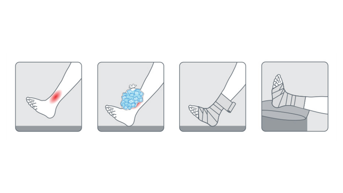 Zvládání zánětu, když se objeví