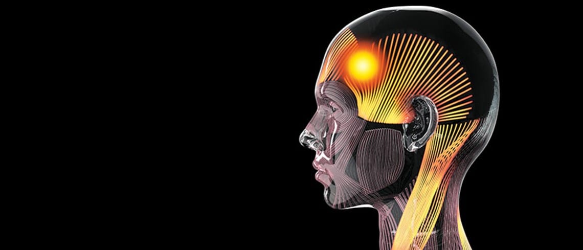 The most common headache doesn’t start in your head