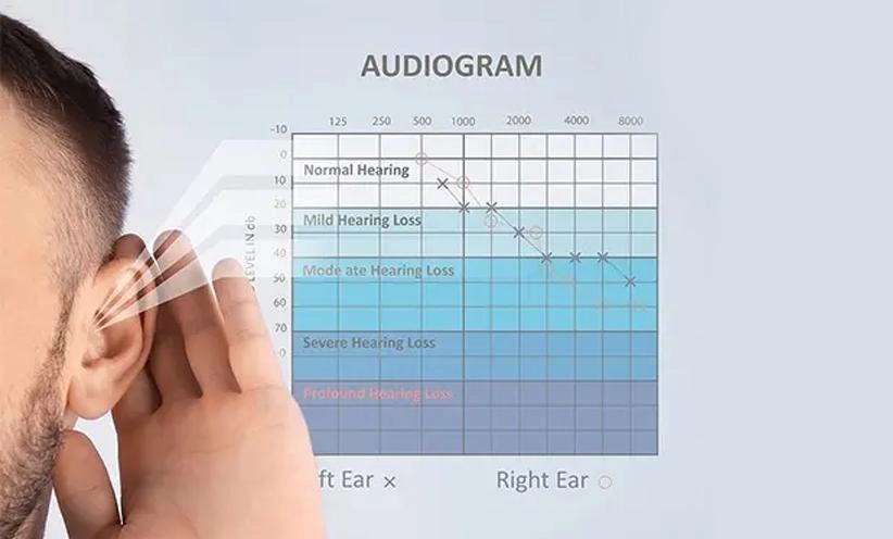 beispiel-audiogramm-ergebnisse.webp