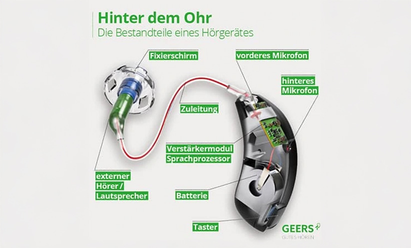 bestandteile-hdo-hoergeraet.jpg