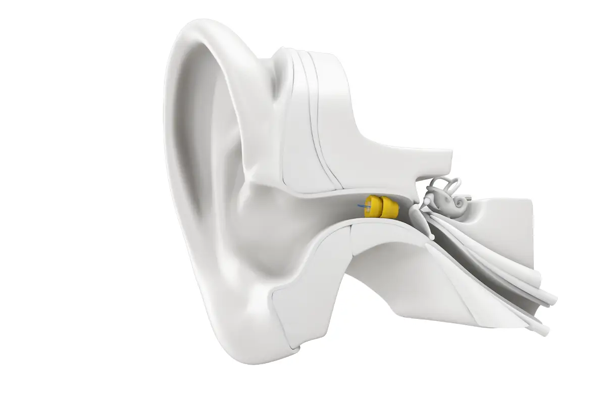 Lyric ear.webp