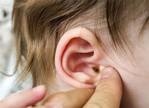 kid-ear.jpg