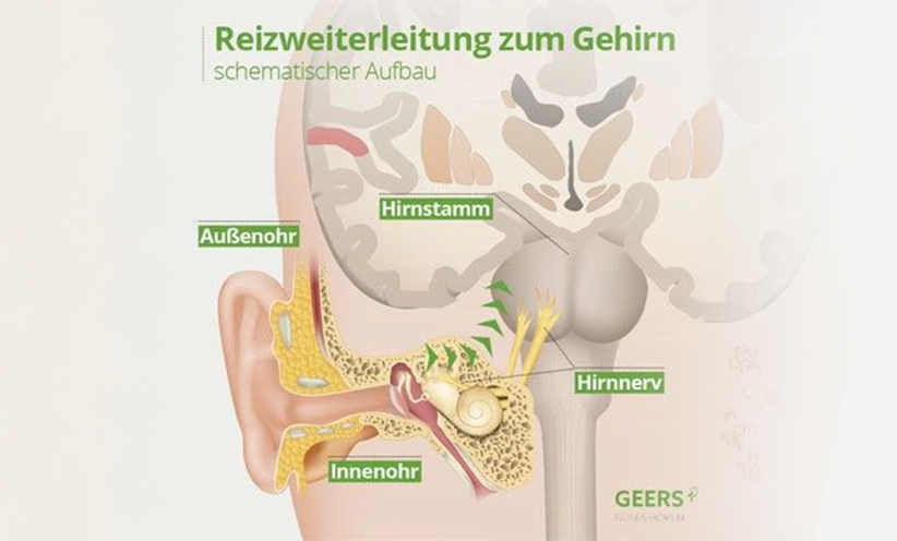 reizweiterleitung-ohr-gehirn.jpg