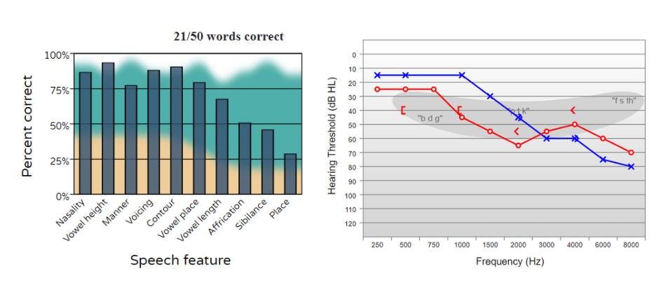 spt-and-audiogram.png