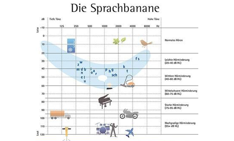 hoerkurve-sprachbanane-audiogramm-382.jpg