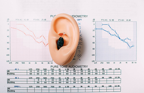 hearing-exam-result-audiogra-500.jpg