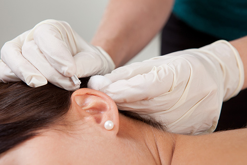 detail-of-an-acupuncturist500.jpg