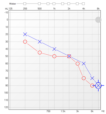 audiogram .png