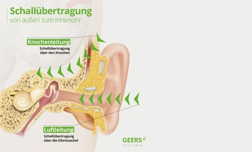knochenleitung-schalluebertragung.jpg