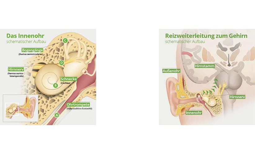 schematischer-aufbau-vom-innenohr-und-reizweiterleitung.jpg