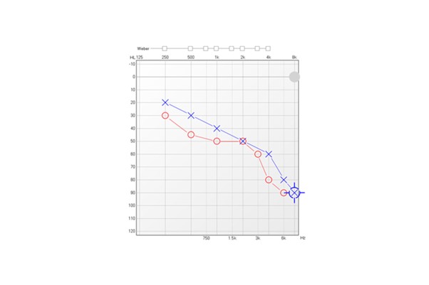 Audiogram med røde og blå markeringer, der viser høretab ved forskellige frekvenser for højre og venstre øre.