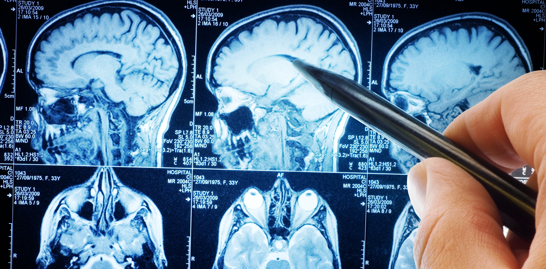 HH_acoustic-neuroma_DESKTOP.jpg