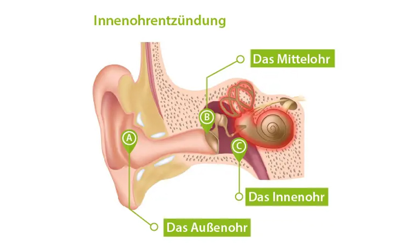 innenohrentzuendung.jpg