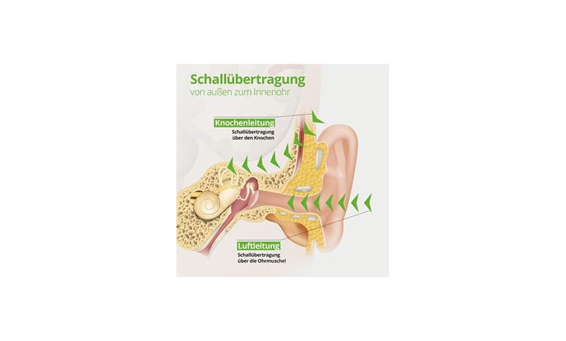 schalluebertragung-von-aussen-zum-innenohr-knochenleitung-luftleitung.jpg