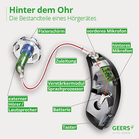 bestandteile-hdo-hoergeraet.jpg